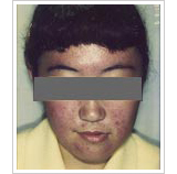 10代女性 4ヶ月後