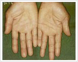 50代男性 3ヶ月後