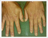 50代男性 3ヶ月後