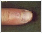 8歳女性 4ヶ月後