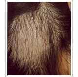 40代女性 5週間後