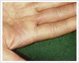 50代女性 13日後