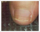 60代女性 8ヶ月後