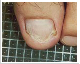 40代男性 3ヶ月後