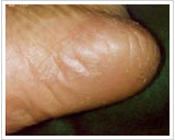 60代女性 15日後