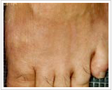 40代男性 10日後